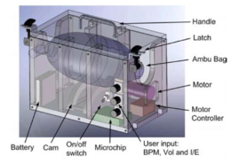 STU and Matador Group develop medical ventilator prototype